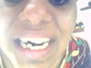 my front tooth
