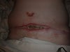 Abdomen immediately after shoer AM 9/3