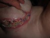 Breast area 2