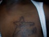 Tattoo greatest dimensions: 4 x 3 inches.  Scar approximately 2 years old.