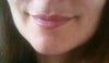 I have some beginnings of jowling on my jaw & under my chin.