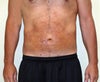 3 weeks post