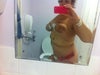 post op flat stomach day after surgery