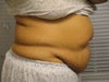 side