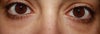 Straight face shot of eyes no smiling.