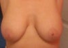 ME FRONT