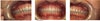 My teeth