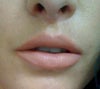 Ideal lips