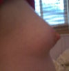 Side View when nipple is unswollen