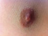 "regular" nipple