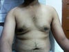 after one month