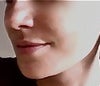 Before-Profile