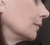 After-Profile
