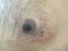 Right nipple and dark area of areola.
