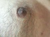 Left nipple.
