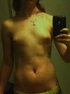 Frontal view