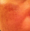 right cheek  (JPG)