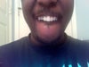 thinking of getting Four veeners over braces