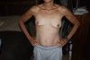pre-op