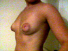 Breasts side view