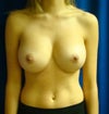 Wish boobs 2