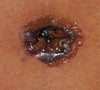 Black Belly Button