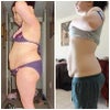 1 yr after c-section (dec/2009-2012)