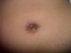 my belly button
