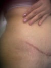 sides