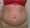 3 months after