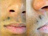 Front/side shot. (last shave about 2 days ago)