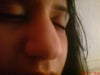 He said that rhinoplasty wouldn't make hardly any difference because there is too much fat on the outside and that needs laser treatment to remove it! so please tell if you think that would work and my nose has been this way since birth!
