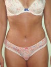 4 1/2 weeks post-op (front)