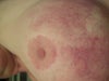 close up of discoloration