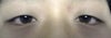 These are my regular eyes