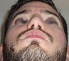 after revision - 9 months