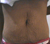 front tummy