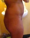 Side