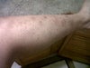 right leg