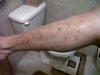 left leg
