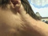 Indent/rolling marks on neck under jaw-line visible.