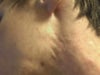 Indent/rolling marks on neck under jaw-line visible.