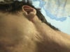 Indent/rolling marks on neck under jaw-line visible.