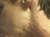 Indent/rolling marks on neck under jaw-line visible.