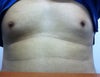 Front view of my nipple