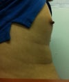 Side view of my nipple
