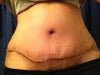 frontal view