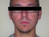 Left side of face is noticably larger than right side