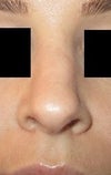 My nose appears large, and asymmetrical to me.