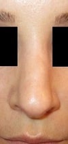 The right side of my nose near the tip is more rounded--the right side curves out more than the left.